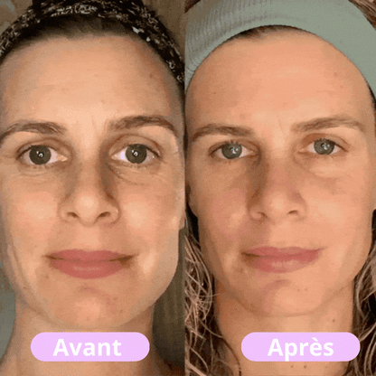 Tolior - Masseur facial LED tonifiant